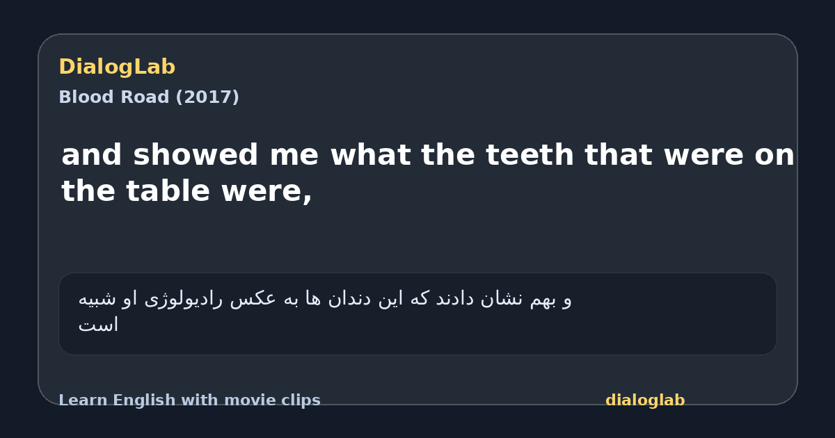 Share card for and showed me what the teeth that were on the table were,